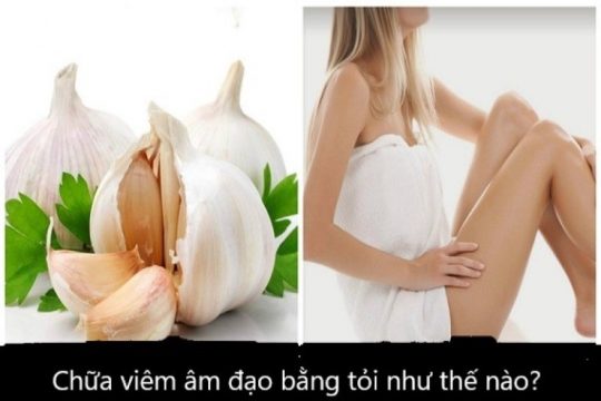 Top 4 cách chữa viêm âm đạo bằng tỏi hiệu quả, an toàn nhất 4 Chữa viêm âm đạo bằng tỏi