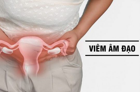 Viêm âm đạo là gì? Triệu chứng, nguyên nhân và cách điều trị hiệu quả nhất 9 Bệnh viêm âm đạo