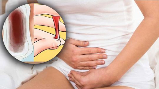 Mãn kinh bị ra máu: Nhận biết nguyên nhân và hướng điều trị 1 đã mãn kinh bị ra máu