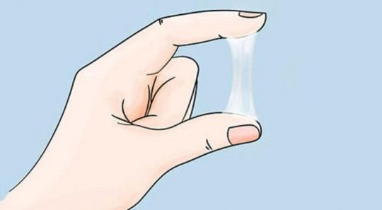 Mãn kinh bị ra huyết trắng: Dấu hiệu bệnh lý chớ coi thường 3 Tư vấn mãn kinh có huyết trắng không