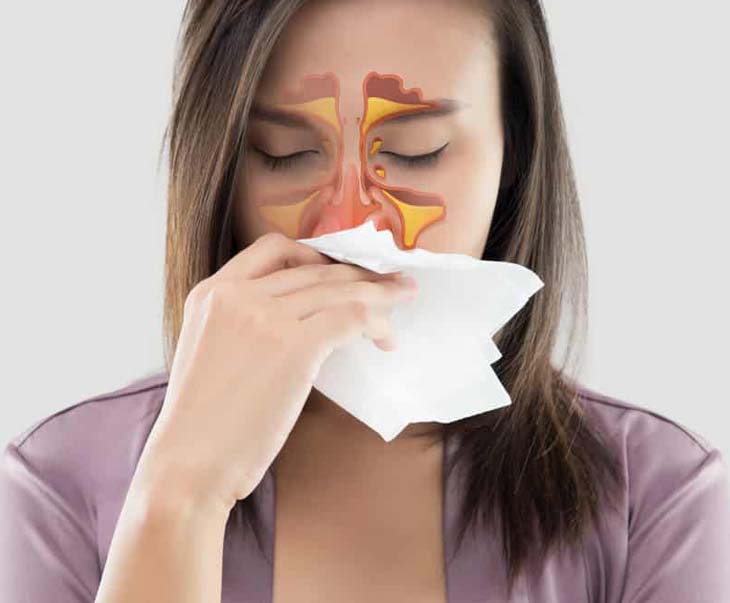 Thảo dược chữa viêm xoang không gây tác dụng phụ như thuốc tây Thảo dược chữa viêm xoang không gây tác dụng phụ như thuốc tây