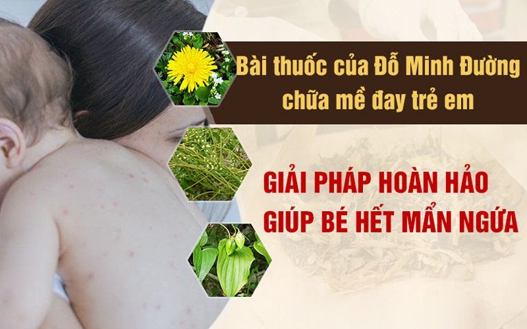 bài thuốc mề đay đỗ minh an toàn cho trẻ bài thuốc mề đay đỗ minh an toàn cho trẻ