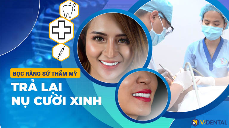 STT Về Răng Sứ: Tất Cả Những Gì Bạn Cần Biết Để Có Nụ Cười Hoàn Hảo