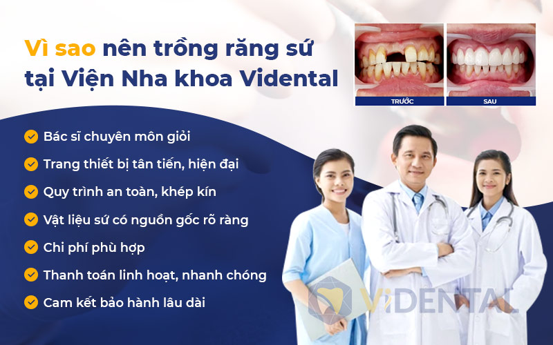 Trồng răng Implant tại TPHCM nhiều khách hàng đã lựa chọn Viện Nha khoa Vidental.